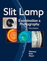 Slit Lamp: Examination and Photography 0615165192 Book Cover