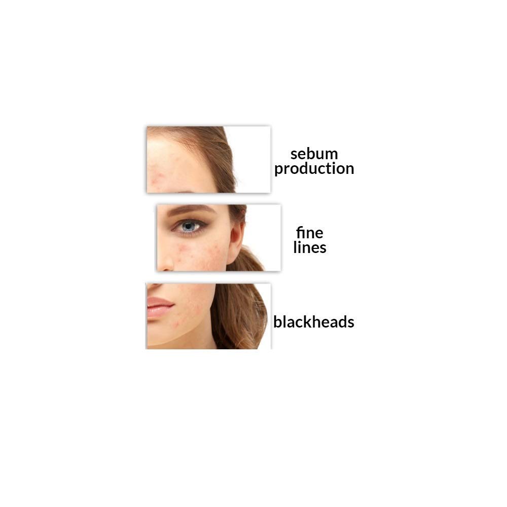 Buy MedPeel Salicylic Acid 10 Peel Perfect for beginners Light