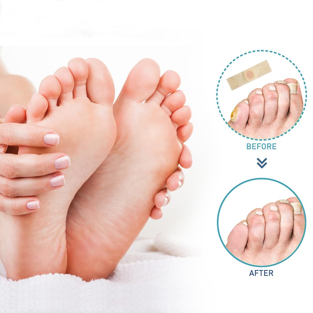 Juego de 24 parches para callos para el cuidado de los pies, respetuoso con la piel que protege contra la presión de los zapatos, almohadillas de eliminación de maíz para adultos, hombres y mujeres