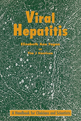 Viral Hepatitis Viral Hepatitis