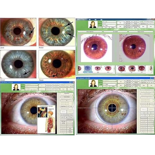 Cámara de iris profesional de 5.0 MP con enfoque óptico de 30 aumentos 5