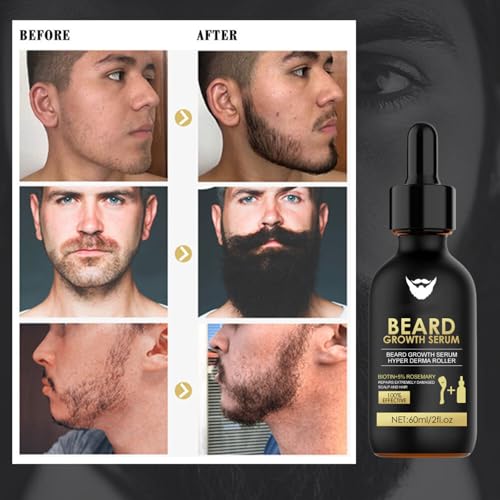 Beard Growth Kit - Beard Growth Oil - Beard Care Kit for Men - With Beard Derma Roller - Beard Kit For for Beard Rapid Growth and Thickening -Gifts For Men Dad Father - Image 6