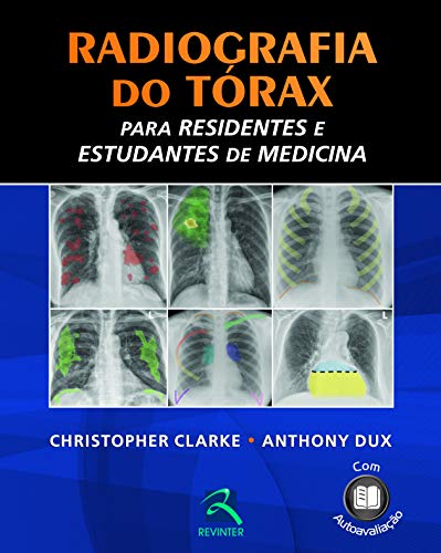 Radiografia do Tórax