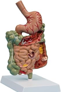 Removerable Teaching Model Human Stomach Anatomy Model Pathological Digestive System Model Stomach Section Large Small Intestine Medical Model Anatomy