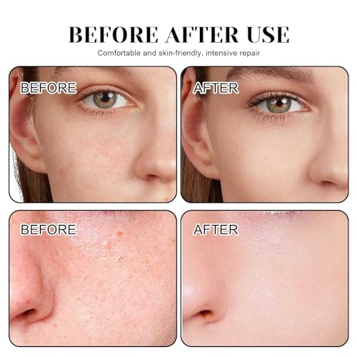 6Pcs Sheet Masks,Hydrating Face Mask Set for Teenage Girls,Face Mask Skincare,Moisturising and Firming Nourishing Face Masks - Soothing Sheet Face Mask - Image 6