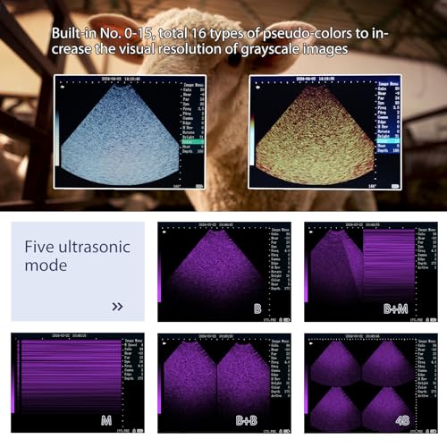 Generic RS-M10 Portable Ultrasound Machine thumb #3