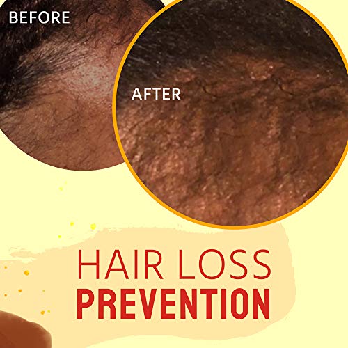 Hair-Oil-Hair-Growth-Oil-100-Natural-Product-for-Hair-Growth-Hair-Growth-Oil-for-Kids-Teens-and-Adults-8-Oz