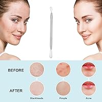 Vista 5 de Professional Blackhead and Blemish Remover -Pimple Comedone Removal 2-in-1 Extractor Tool -by La Chat (Short)