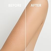 Vista 8 de Microdermabrasión Queratosis Pilaris y acné Exfoliante de limpieza profunda facial y corporal, borrador de golpes KP, exfoliante para el acné