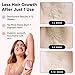 RoseSkinCo Lumi IPL Laser Hair Removal Device, At Home Permanent Hair Reduction on Face, Bikini, Legs, Arms, Underarms, Safe & Gentle Intense Pulsed Light Handheld Device, Rose/Gold