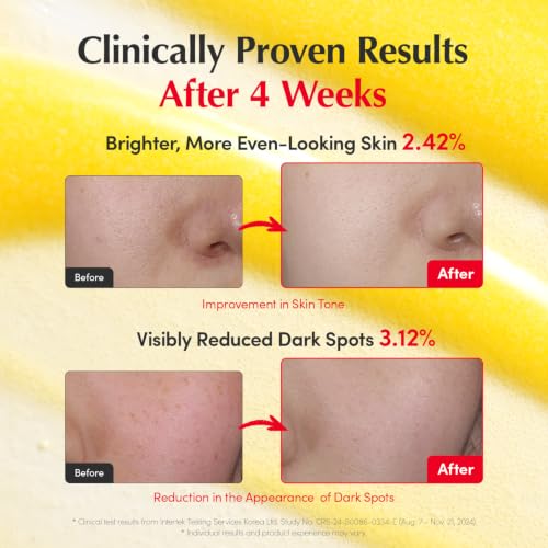 EQQUALBERRY Vitamin Illuminating Serum | Niacinamide 4% & TXA | Brightening Vitamin C Serum for Face Glow with Hyaluronic Acid | Dark Spot & Uneven Tone Care | Korean Skincare, 1.01 fl oz - Image 5