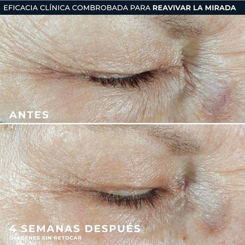 RoC - Multi Correxion Hydrate + Plump Crema de Ojos - 3 en 1 - Levanta y Reafirma el Contorno de Ojos - con Ácido Hialurónico - 15 ml - imagen 5