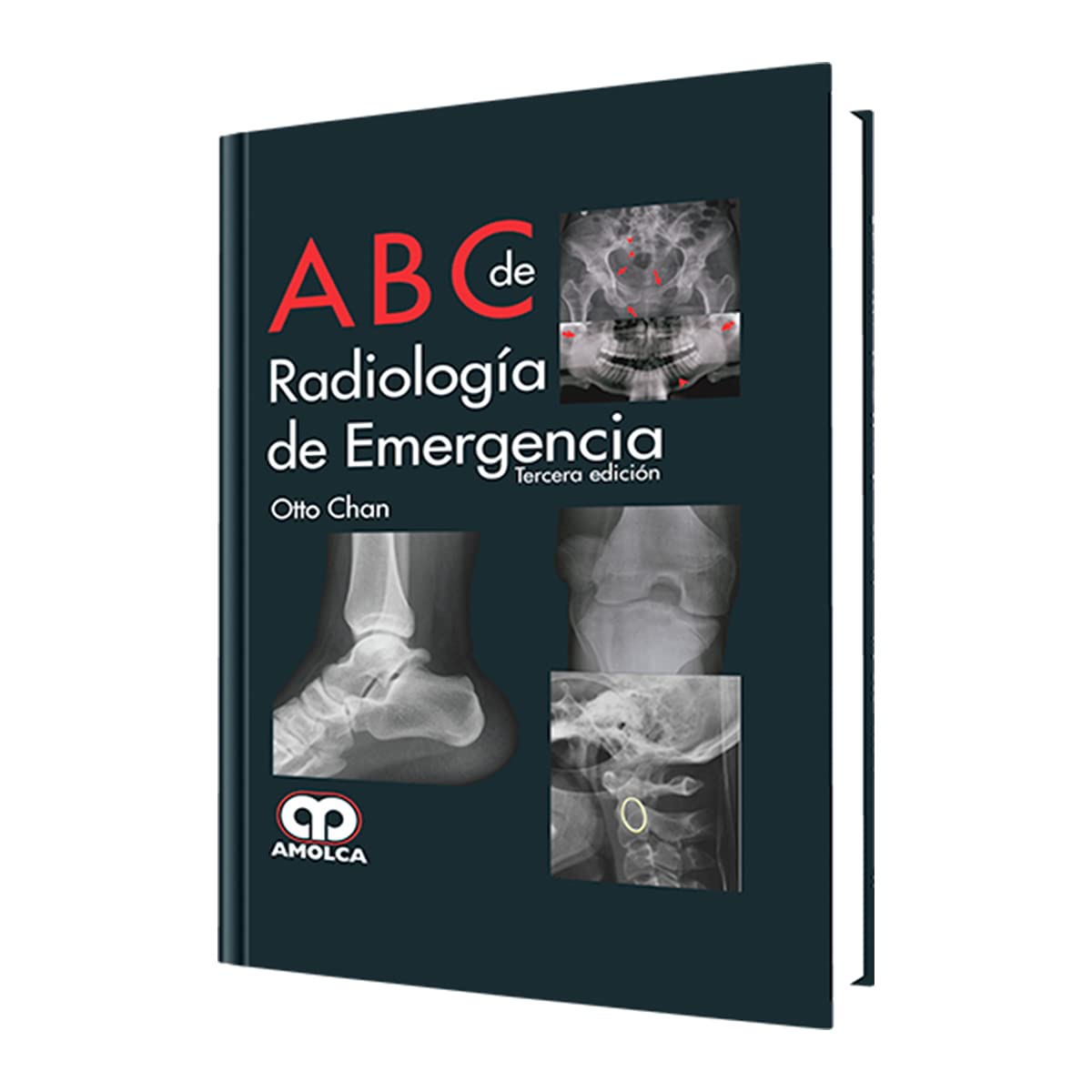 ABC DE RADIOLOGIA DE EMERGENCIA