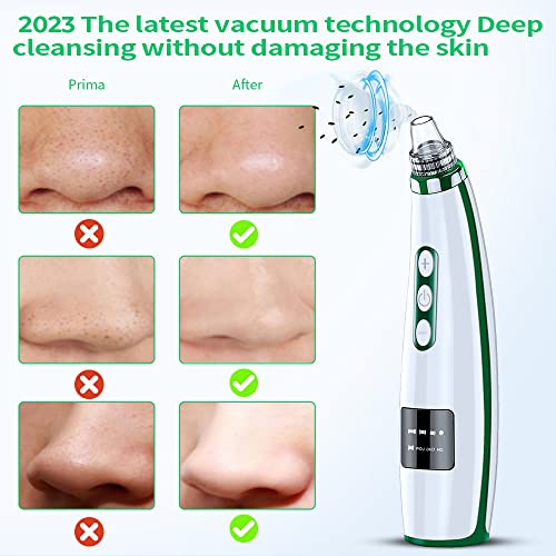 2023-Newest-Blackhead-Remover-Pore-VacuumUpgraded-Facial-Pore-CleanerElectric-Acne-Comedone-Whitehead-Extractor-Tool-5-Suction-Power5-ProbesUSB-Rechargeable-Blackhead-Vacuum-Kit-for-Women-Men