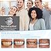 3 Sets Veneers Teeth - Easy to Use, Natural Look, Portable, Ideal for Instant Smile, Snap On Veneers for Men and Women