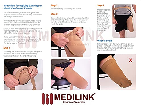 Medilink Above Knee AK Stump Shrinker Sock for Amputee Limb Compression & Post-Surgery Care | Breathable Ventilated Fabric | Reduces Swelling & Promotes Healing | Comfortable Fit, Beige, Extra Large Size 1