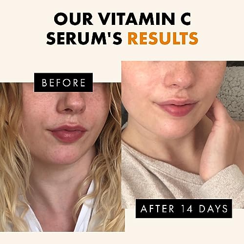 Vitamin C Face Serum - Hyaluronic Acid, Retinol, & Vit E - Anti Aging Facial Brightening Serum for Skin Care - Timeless Pure Vitamin C Serum for Face Dark Spots, Vit C Serum Oil, Face Serum for Women