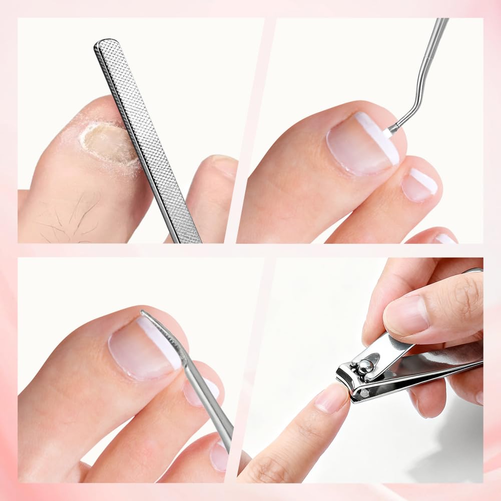 Ingrown Toenail Corrector Strips Set, Home Pedicure Kit for Men & Women, Breathable Nonwoven Nail Correction Patches, Easy At-Home Use for Ingrown Toenail Relief