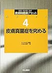 アトピー性皮膚炎―湿疹・皮膚炎パーフェクトマスター (診る