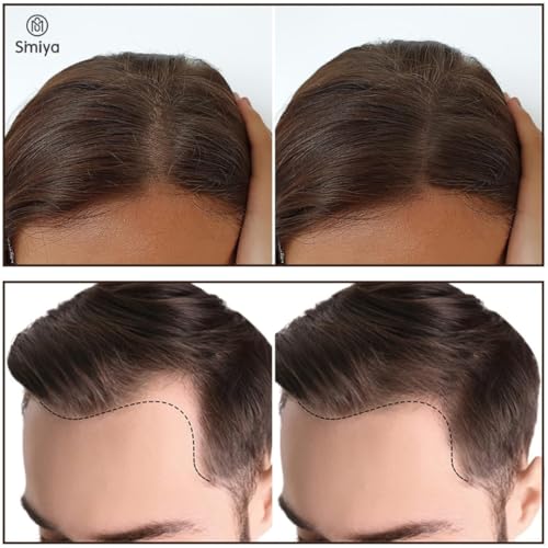 Image of SIMIYA Instant Natural Hairline Colour Touch-Up Powder for Women & Men - Black | Hair Shading Sponge Pen, Hairline Shadow Powder Stick, Quick Hair Root Touch-Up Stick (Black, PACK OF 1)