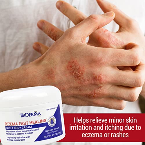 Triderma Eczema Fast Healing Face And Body Cream, Maximum Strength Itch And Rash Relief, Non-Greasy, No Cortisone, 8 Ounce Jar #TOP1