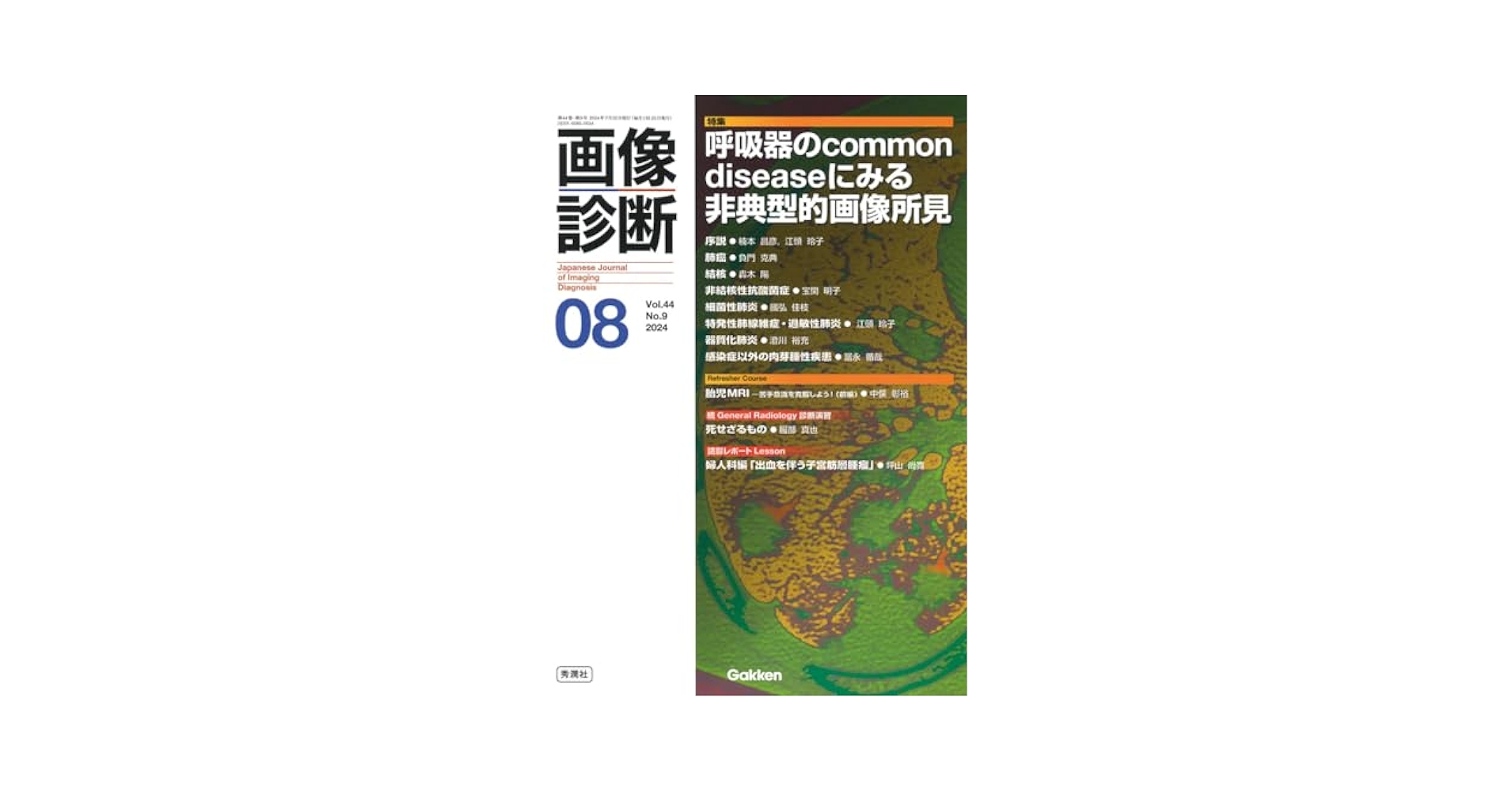 画像診断2024年8月号 Vol.44 No.9: 呼吸器のcommon diseaseに