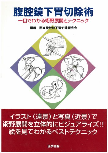腹腔鏡下胃切除術―一目でわかる術野展開とテクニック 腹腔鏡下胃切除術―一目でわかる術野展開とテクニック