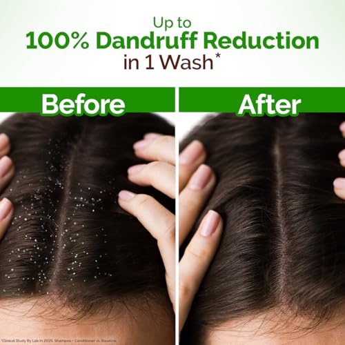 Image of Mamaearth Lemon Anti-Dandruff Shampoo with Lemon, ZPTO, Climbazole, Aloe Vera for Itchy & Flaky Scalp | Upto 100% Dandruff Reduction & 3X Softer Hair in 1 Wash | Soothes Scalp | Reduces Frizz | 600 ml