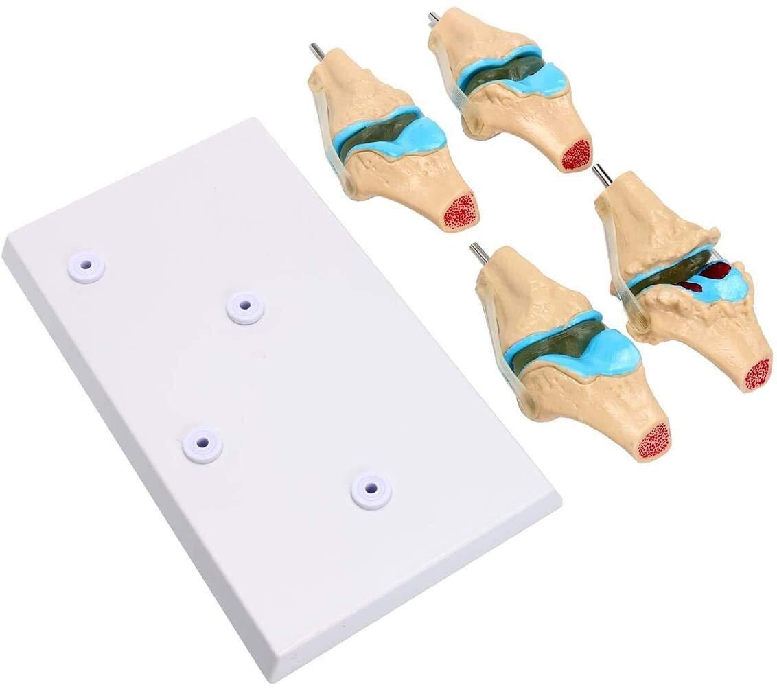 Modele medyczne, ludzki szkielet stawu kolanowego Model anatomiczny nauka medyczna materiały dydaktyczne osteoporoza modele stanu chorobowego 1 zestaw odłączany