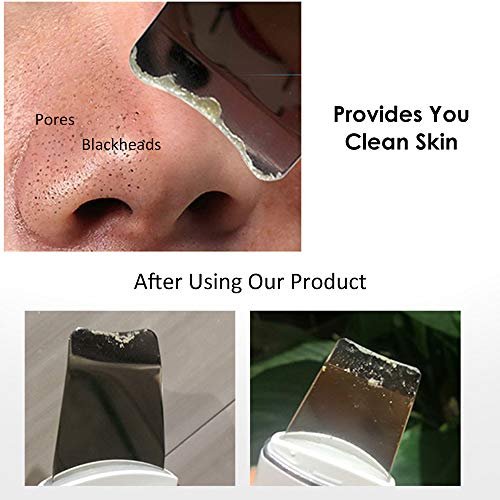 Máquina de limpeza facial, Andoer Dispositivo de limpeza facial vibratório para limpeza de pele remo