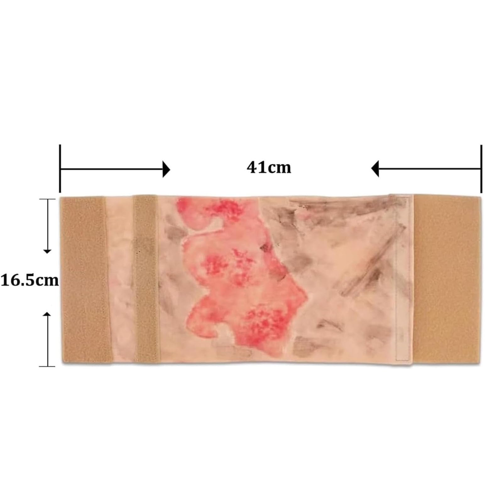 Modello Simulato di Ustioni per Ferite, Modello di Allenamento per Ustioni degli Arti a 2-3 Gradi, Ampone Dimostrativo Indossabile per Lesioni da Ustione, Design Dall'aspetto Realistico