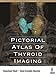 Produktbild Pictorial Atlas of Thyroid Imaging