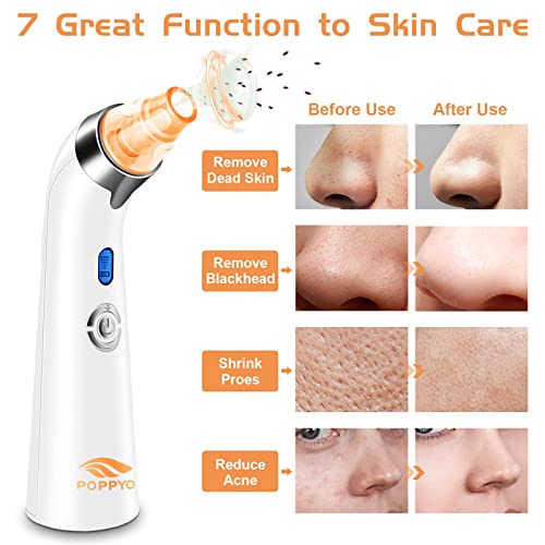 Blackhead Remover Vacuum, POPPYO Blackhead Pore Vacuum, Electric Facial