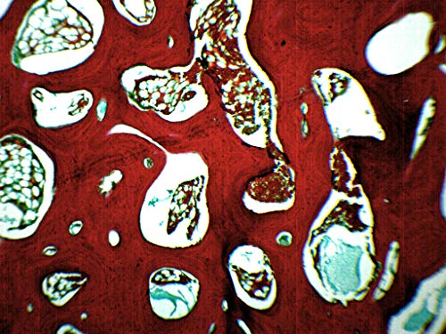 Image of EISCO Spongy Bone Section (Mammal), Prepared Microscope Slide - 75 x 25mm Anatomy, Biology & Microscopy- Eisco Labs