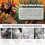 African Black Soap for Face & Body Wash, Raw Unrefined Natural Soap for Acne, Blackhead Removal, Fades Dark Spots, Hydrates & Balances Oily Skin, Anti-Ageing - Image 4