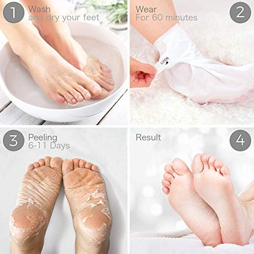 image for WOAYUS Foot Peel Mask, 2 Pack Exfoliating Foot Peeling Spa Masks for D