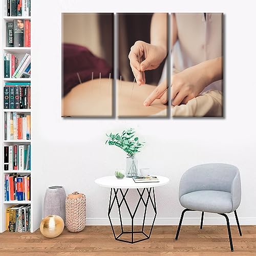 Image of TUMOVO Physical Therapists do Acupuncture Canvas Wall Art Traditional Chinese Medicine Canvas Photo 3 Panels Prints for Wall Decor Giclee Print Gallery Packaging Artwork Ready to Hang (42 inch Wx28 H)