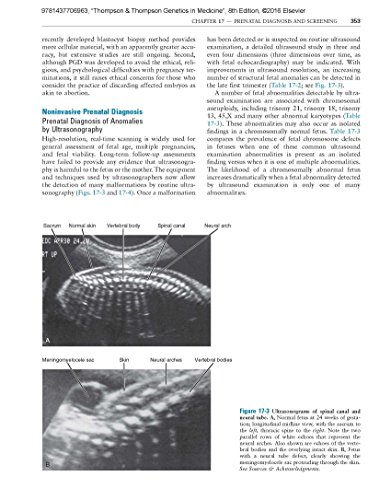 Thompson & Thompson Genetics in Medicine (Thompson and Thompson Genetics in Medicine) - Image 4