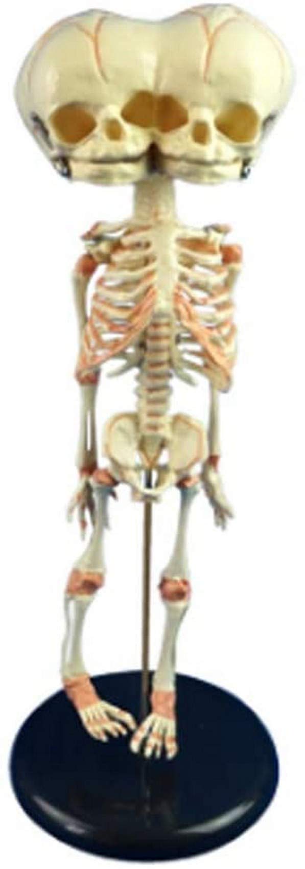 Amazon.co.jp: 奇形双頭人間胎児（幼児）頭蓋骨スケルトン医療教育援助