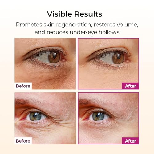 Image of Dr.Melaxin Calcium Multi Balm Stick 9g | Collagen & Elastin Wrinkle Care for Under Eye, Neck & Face | Korean Skin Care Anti Aging Moisturizing Balm Stick for Fine Lines & Dry Skin