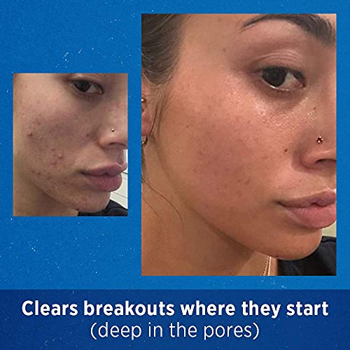 Differin Acne Retinoid Treatment Gel - Image 6