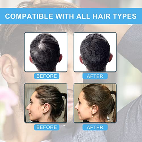 Shifakou Hair Building Fibers For Thinning Hair With Spray Applicator Pump Nozzle thumb #2