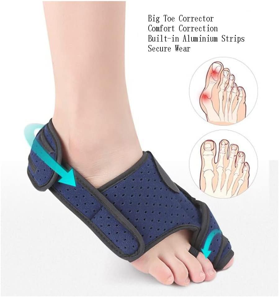 DEAVER Toe Straightener -Big Hallux Overlap Orthosis,Hallux Valgus Splitter,Correction Belt Bunion Splints,Big Straighteners and Relief Guide,Adjustable