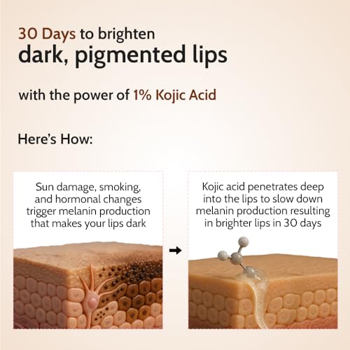 Image of Chemist At Play Natural Lip Balm with SPF 50 PA++++ | 1% Kojic Acid & Ceramides | Lip balm for Dark and Dry Lips | Moisturising Lip Balm | Brightens Dark Lips | For Men & Women | 4.5 g