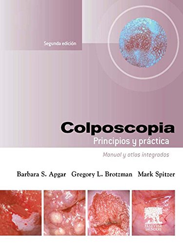 Colposcopia. Principios y práctica: Manual y atlas integrados (Spanish Edition) Colposcopia. Principios y práctica: Manual y atlas integrados (Spanish Edition)