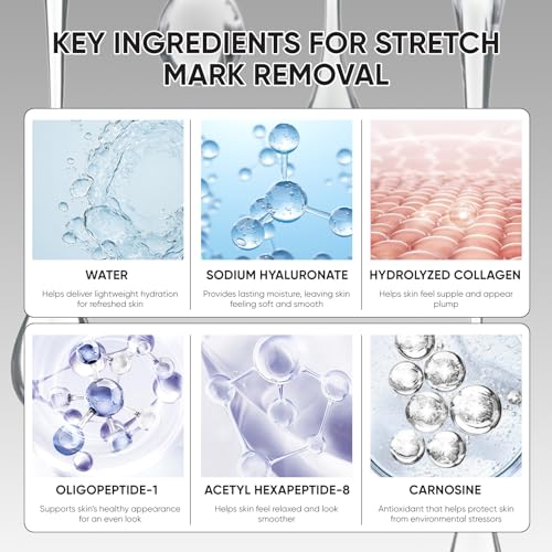 Stretch Mark System for Skin Care - Stretch Marks Removal, At-Home Beauty Tool for Postpartum Skincare | Improve the Look of Uneven Skin Texture, Firmness & Smooth, Glowing-Looking Skin