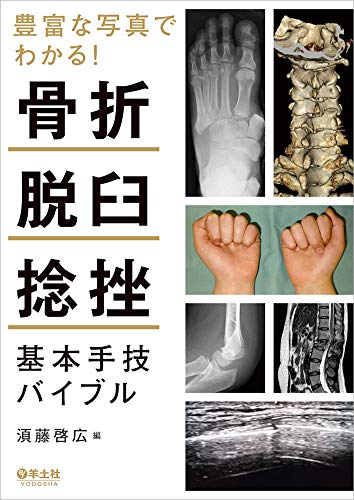 PDFダウンロード 豊富な写真でわかる! 骨折・脱臼・捻挫 基本手技バイブル バイ