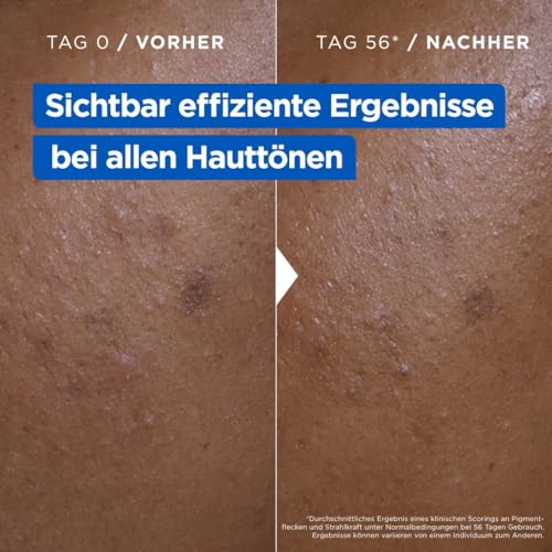 Mixa feuchtigkeitsspendende Anti-Pigmentflecken Allzweckcreme, Geeignet für Gesicht, Körper & Hände, Niacinamide Bright, Hypoallergen, 400 ml