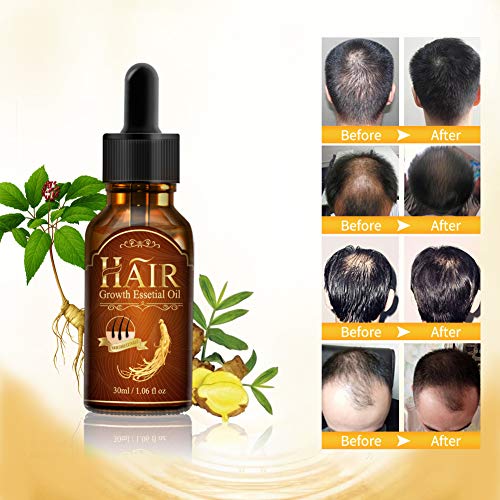 Bestidy Hair Growth Essential Oil Fleeceflower Root Ginger Extract Hair Care Serum Stops Hair Loss Promotes Hair Regrowth Topical Treatment for Thinning Hair for Women & Men