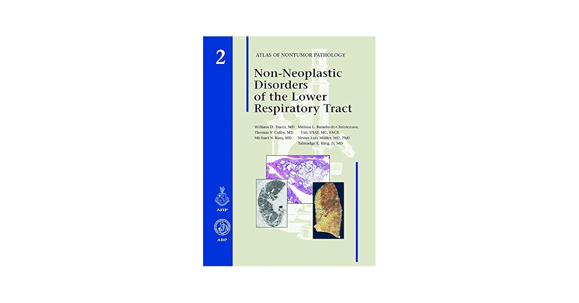 健康・医学 Diagnostic Atlas of Non-Neoplastic Lung Diagnostic Atlas of Non-Neoplastic Lung Disease: A Practical
